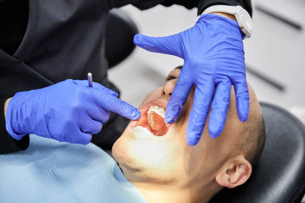 Best Emergency Dental Care for Broken or Chipped Teeth in Mccullom Lake, IL